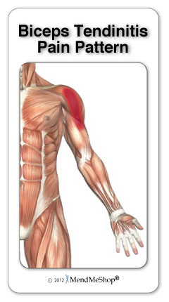 bicep tendonitis pain pattern