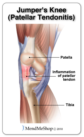 Patellar tendon in the kneecap