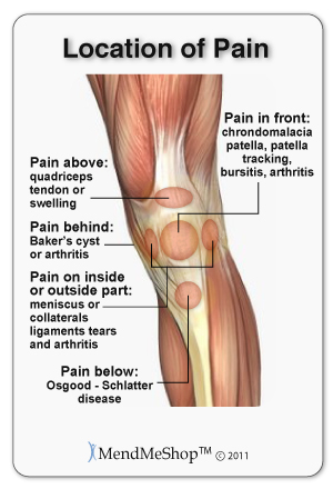 The location of your pain can vary based on the type of tendonitis you may be suffering from.