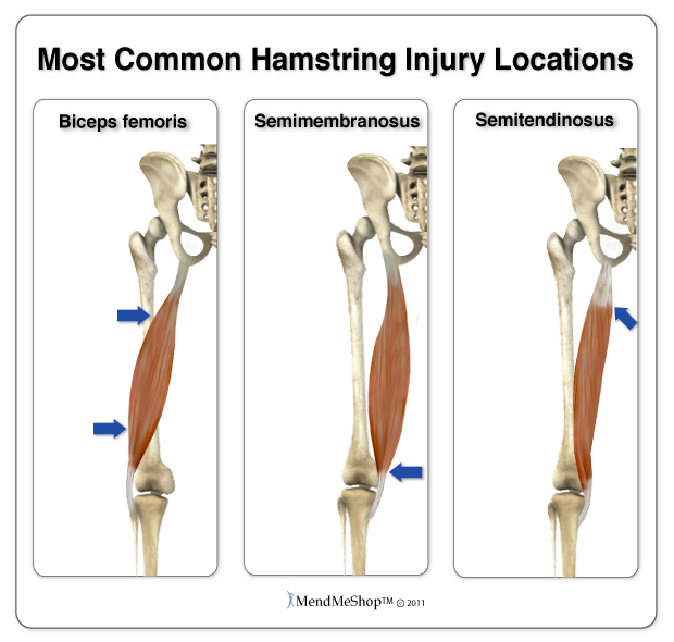 the hamstring is easily injured when the muscles are weak