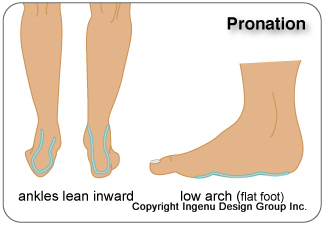 If your ankles lean inward you might also have a low arch or flat foot